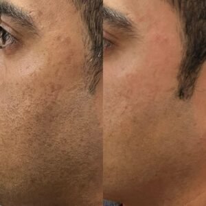 20 days transformation