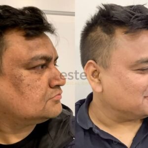 30 days transformation