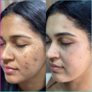 25 days transformation